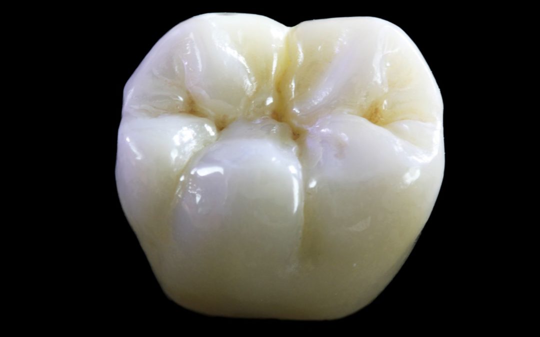 Il top dell’estetica dentale? Le corone in zirconio!