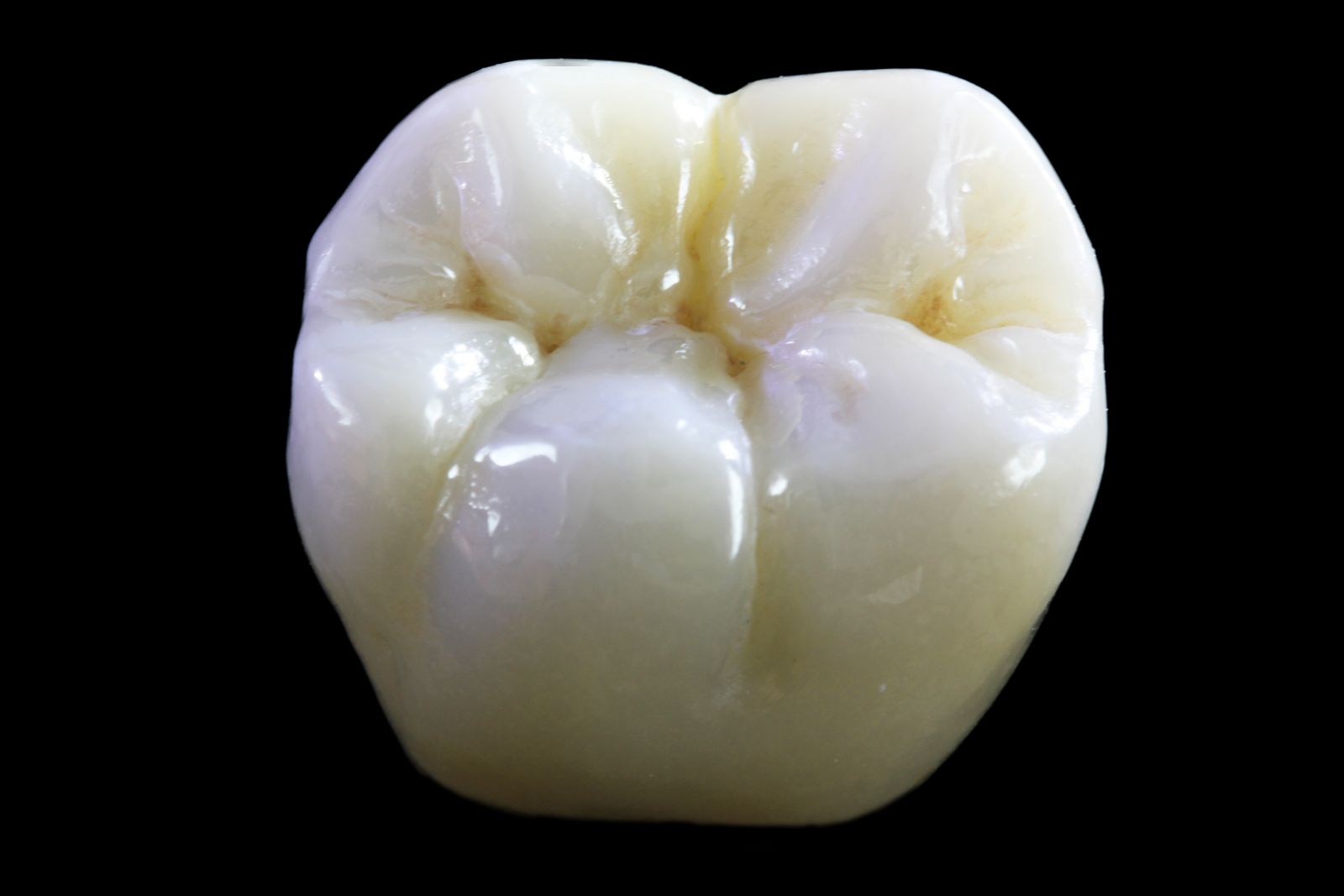 Corone in zirconio, il top dell'estetica dentale Studio dott. Maini