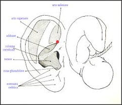 Auricolo Terapia Rovereto