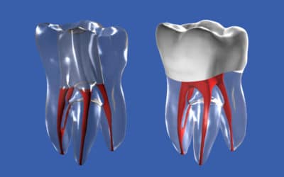 Dottore ho un granuloma al dente, è grave?