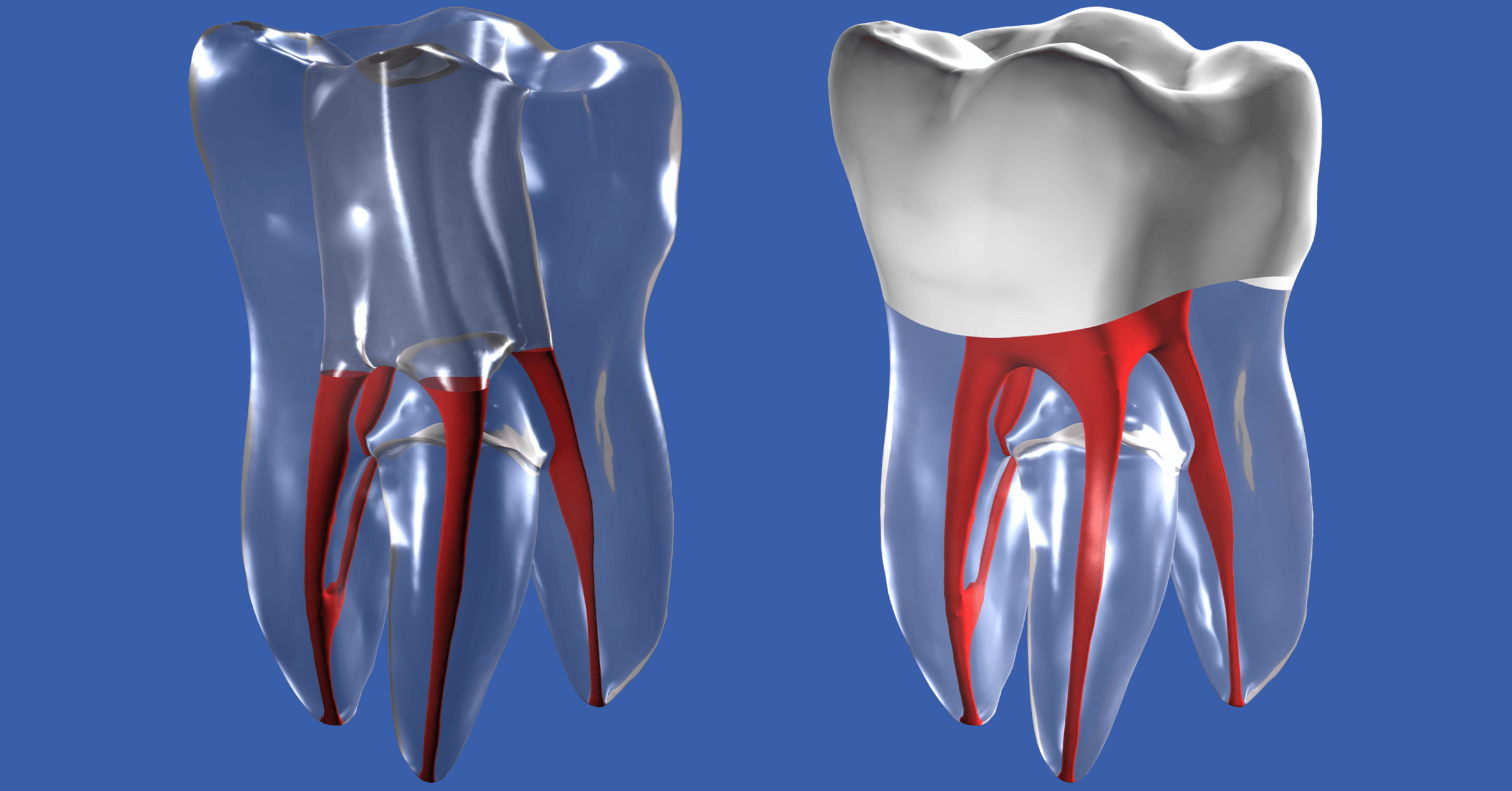 infezione dentale grave