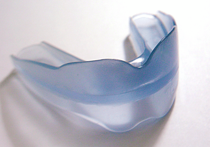 Equilibratore dentale progetto