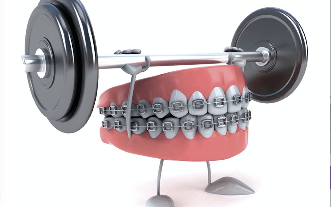 mamma ho i denti storti maini
