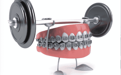 Leggi gratis i primi due capitoli di “Mamma ho i denti storti!”