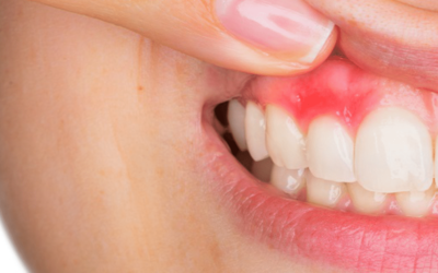 Cosa fare per mantenere in salute denti e gengive