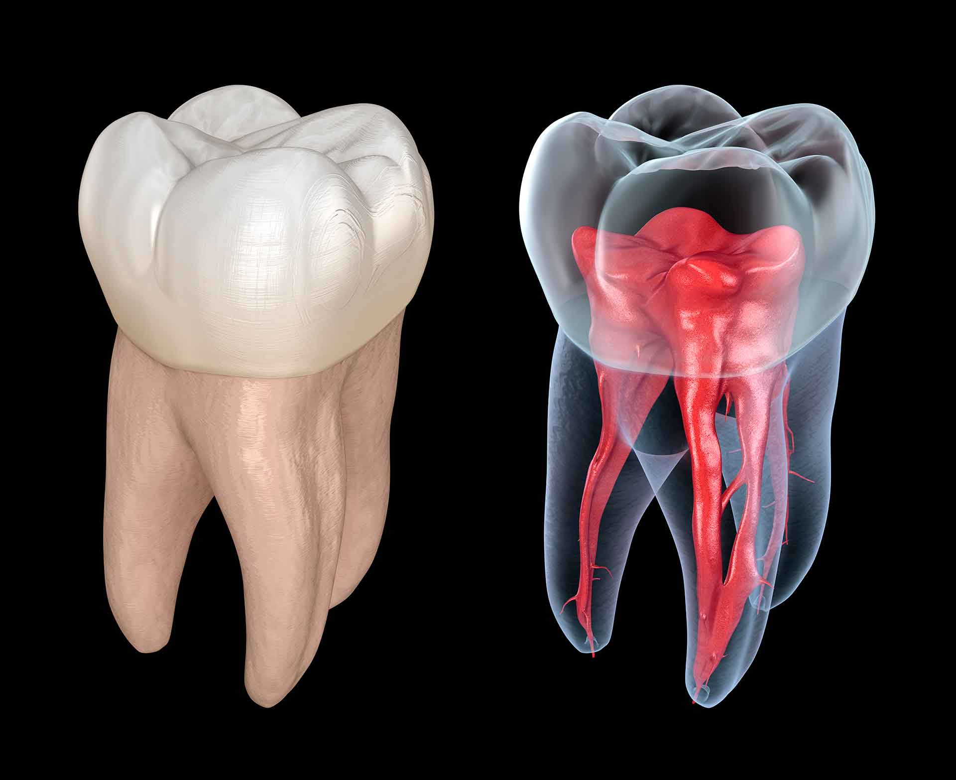 dentista rovereto maini endodonzia